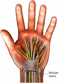 Carpal Tunnel Release - By Dr Jayakrishnan